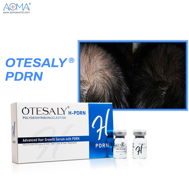 头发养护 5ml 头发生长含 PDRN 生发注射刺激毛囊