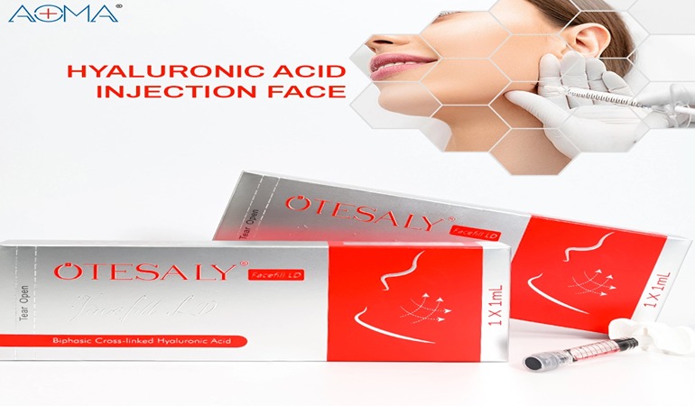 鼻唇溝填充術前後：18 個月長壽案例