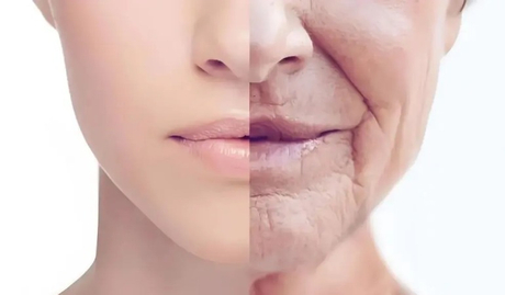 Lip Volume & Perioral Rejuvenation Thuto ya mohlala ya HA filler ya nako ye telele go melomo.jpg .