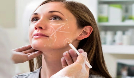 2025 年註射美容市場 HA 或 CaHA 或 PLLA 趨勢和 AI 角色.jpg