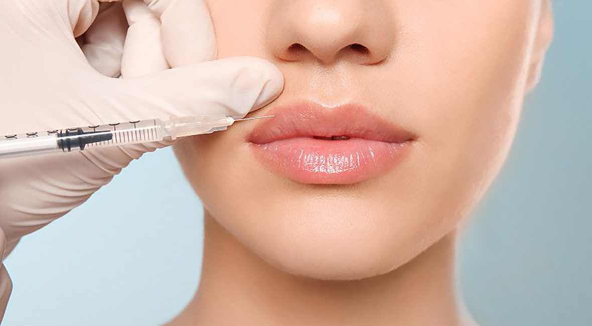 探索用于丰唇的高端透明质酸真皮填充剂