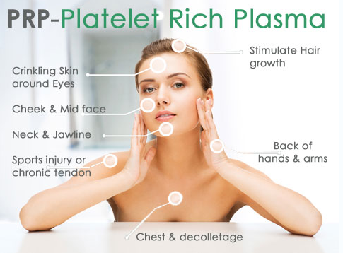 釋放富血小板血漿 (PRP) 療法對皮膚滋養的功效